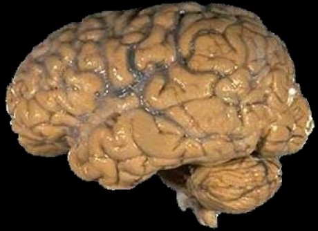 Human_brain_NIH